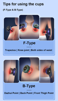 OEM/ODM Body Fitdash F-Type Cupping Cups voor aangepaste Hijama Cupping Therapy Massager