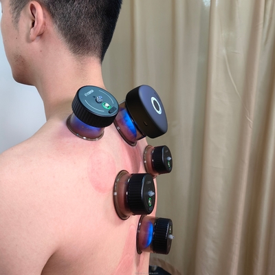 Fitdash Infrarood Cupping Elektrische Vacuüm Cupping Massage Body Cups Cupping Machine Vacuümtherapie