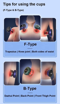 OEM donkergrijze elektrische cupping kit voor design slimme cupping cups therapie massager sets