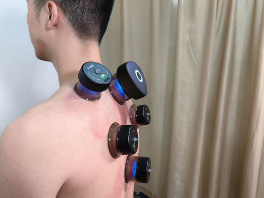 Fitdash Smart Massage Cupping Vacuum Cupping Therapy Machine Set met knopcontrole