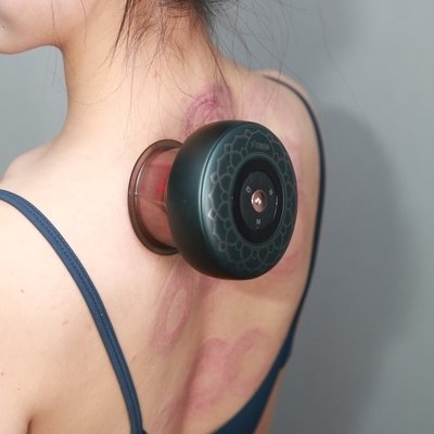 Smart Cupping Therapy Massager Gezicht Electric Gua Sha Schrapen voor fysiotherapie