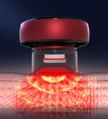 GB4706.10-2008 Veiligheidsstandaard Fitdash 1800mAh Vibration Cupping Therapy Instrumenten
