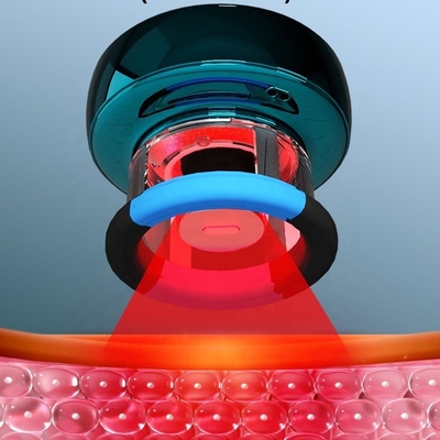 Fitdash Professional TENS Cupping Equipment Elektrische vacuümcupping therapie en rood licht