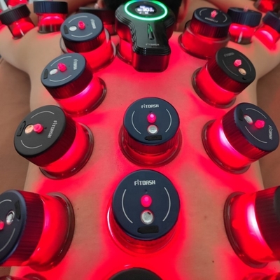 Verbeter uw cupping ervaring met Fitdash Smart Cupping Device's infrarood rood licht