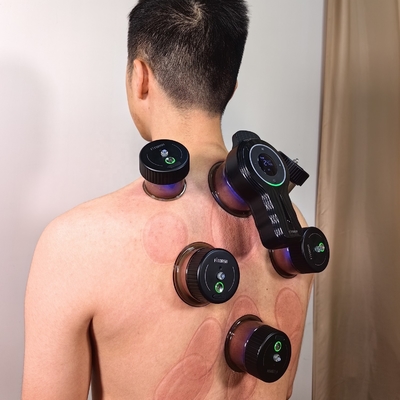 Ervaar de voordelen van elektrische vacuümcupping therapie met ons cupping apparaat