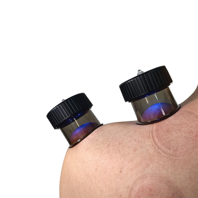 Buttonsysteem Vacuümademhaling Cupping Massage voor de behandeling van anti-cellulitis