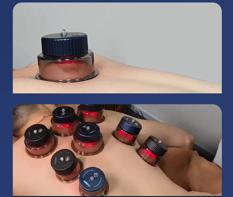 Buttonsysteem 3.7V/1800mAh Elektronisch Cupping-apparaat Massager met roodlichttherapie