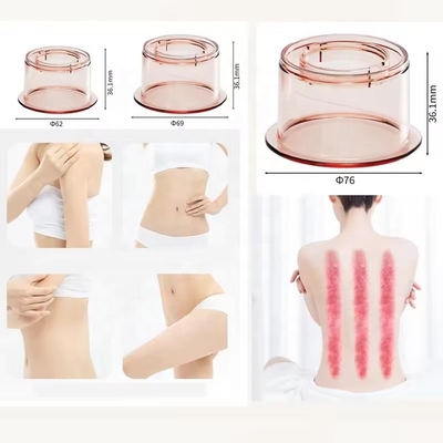 Fitdash Digitaal Meridian Cupping Device Cupping Therapy met -60-0 kPa Zuigintensiteit