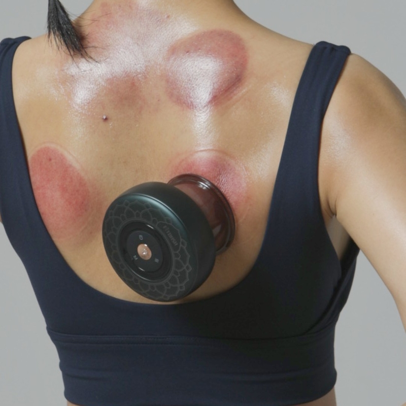 Stroombron Charge Professionele Gua Sha Massage Tool voor Cellulitis Reductie ABS P