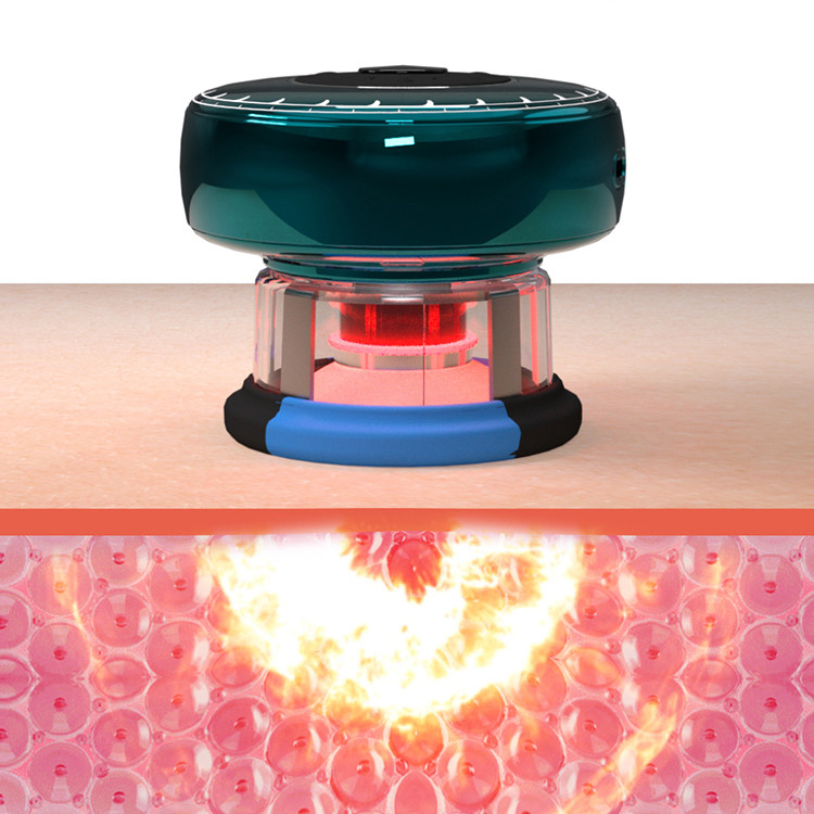 Fitdash TENS Smart Vacuum Cupper Oplaadbaar en gemakkelijk om de bloedcirculatie te verbeteren