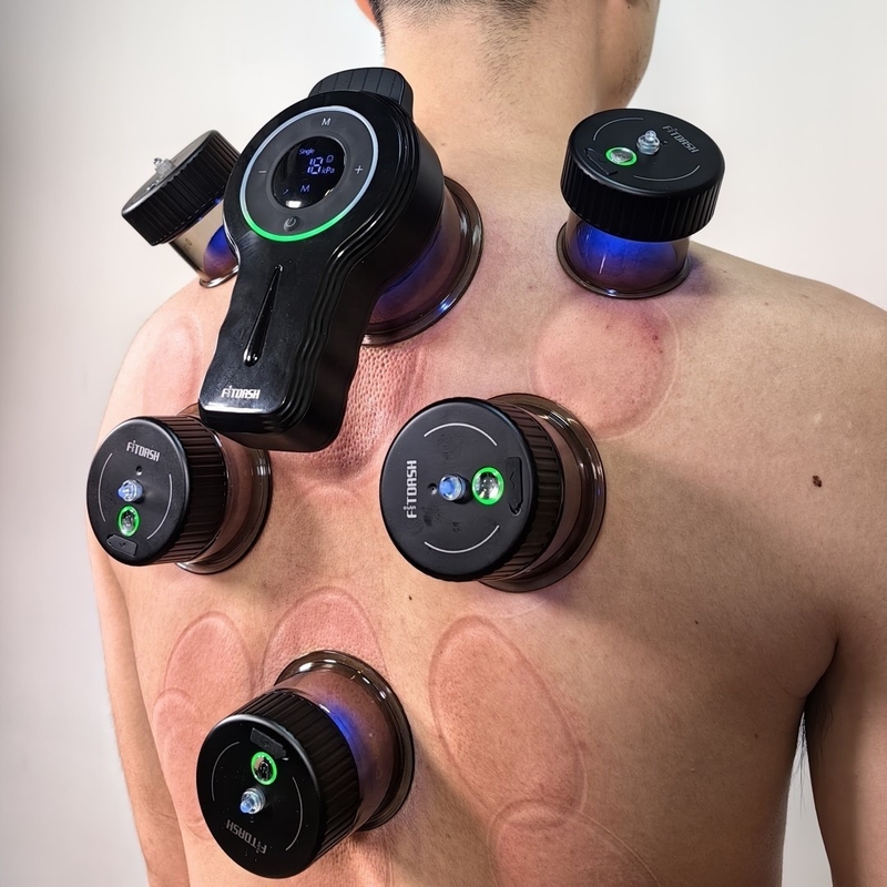 Ondersteuning ODM/OEM Fitdash Upgraded Intelligent Electric Vacuum Cupping Set voor Gua Sha