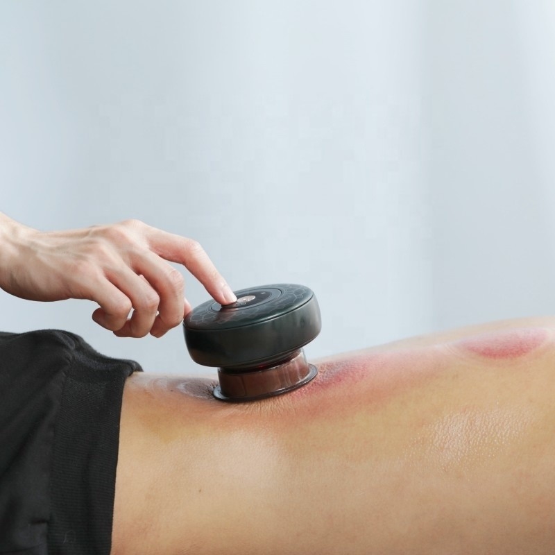Fitdash Electric Cupping Massage met rood licht therapie voor pijnverlichting EMC gecertificeerd